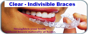 Invisibel-braces-by-Dr-Agrvat-Dental-Tourism-Ahmedabad-gujarat-India-2